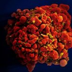 HIV research cure