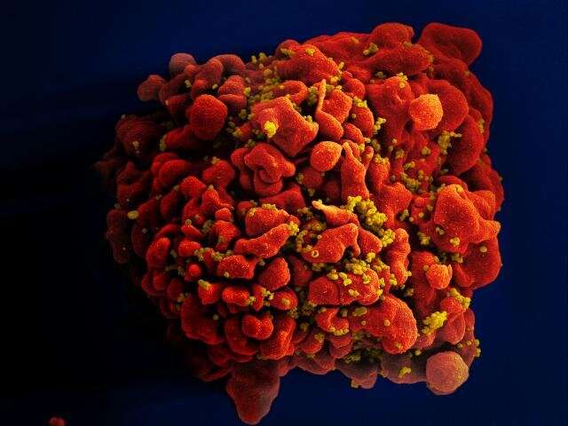 HIV research cure
