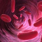 anaemia
