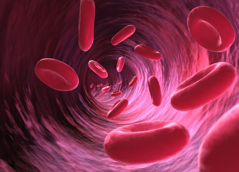 anaemia