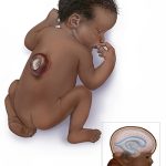 congenital abnormalities