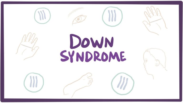down syndrome