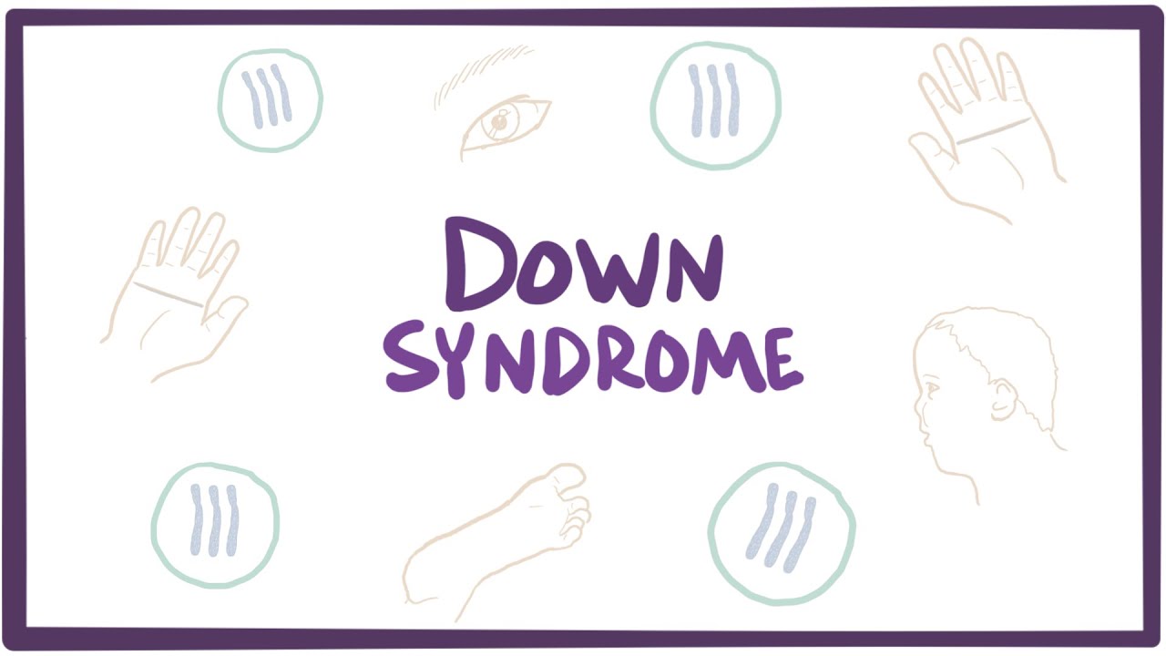 Down Syndrome